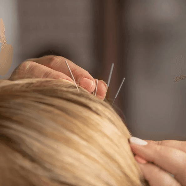 ProCare Acupuncture & Wellness