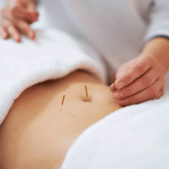 ProCare Acupuncture & Wellness