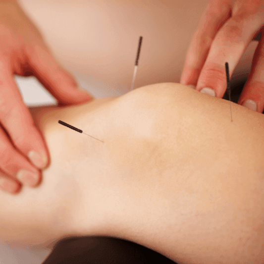 ProCare Acupuncture & Wellness